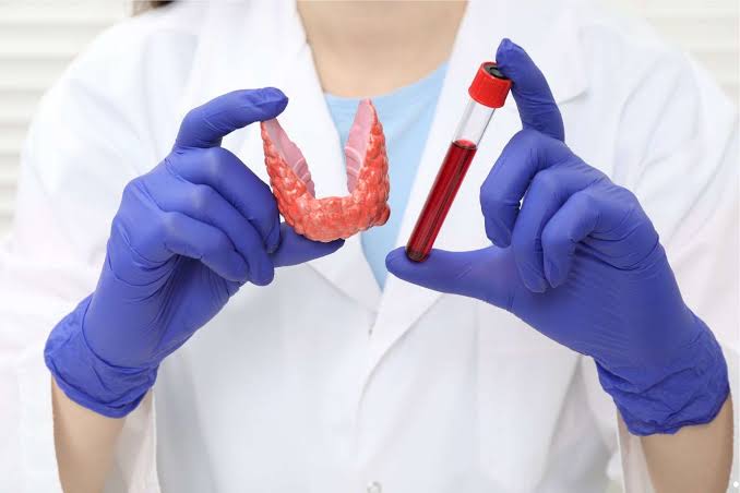 BIOCHEMICAL INTERPRETATION OF THYROID FUNCTION TESTS: A GUIDE FOR PRACTITIONERS
