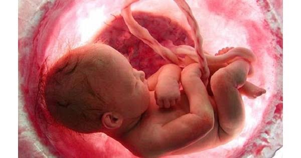 INTRAUTERINE FETAL DEATH