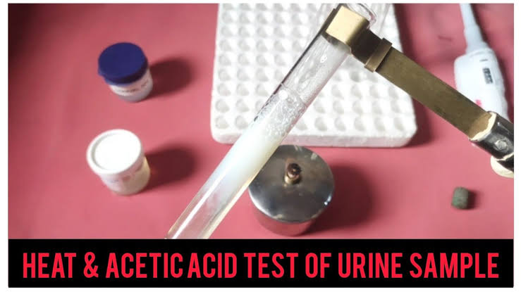 DEMONSTRATING THE PRINCIPLE OF PROTEIN DETECTION BY HEAT METHOD IN URINE