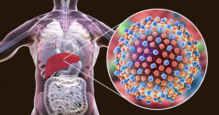 HEPATITIS AND ALCOHOL LIVER DISEASE