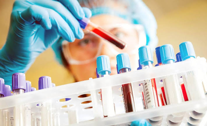 EASY GUIDE TO CHECK YOUR ABO AND RH BLOOD TYPES