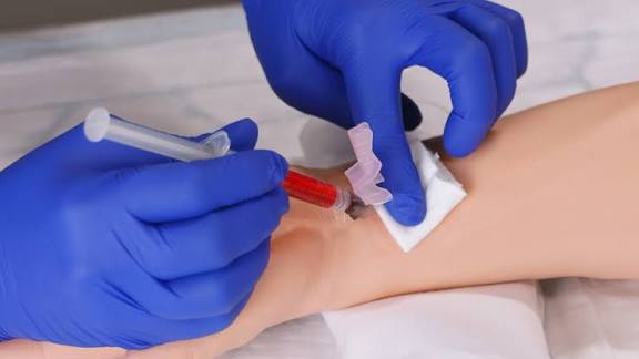 ARTERIAL BLOOD SAMPLING: MASTERING THE PROCEDURE, ANALYSIS, AND INTERPRETATION