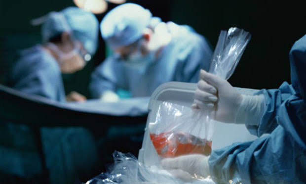 BEST PRACTICES FOR ORGAN DONATION MANAGEMENT