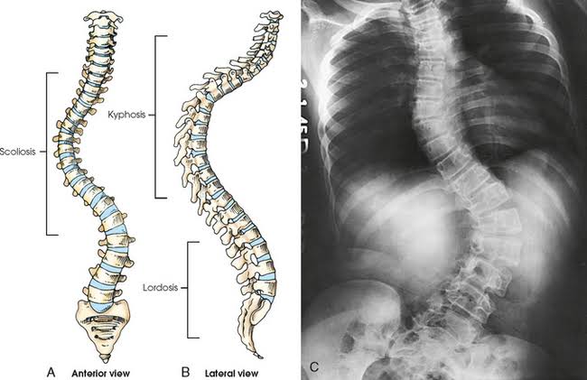 MASTERING RADIOGRAPHIC TECHNIQUES FOR VERTEBRAL COLUMN IMAGING