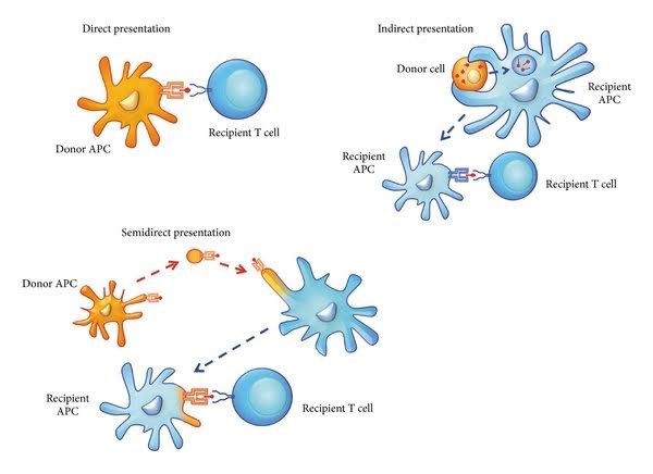 WHAT IS ALLOSENSITIZATION AND HOW DOES IT AFFECT TRANSPLANT PATIENTS
