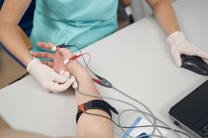 NERVE CONDUCTION VELOCITY: TECHNIQUES, IMPORTANCE, AND ESTIMATION TIPS