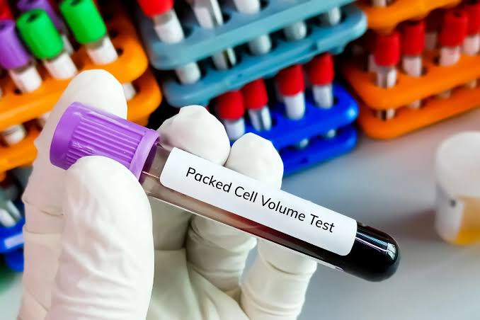 KEY FACTS ABOUT HEMOGLOBIN, PCV, RBCs, AND WBCs