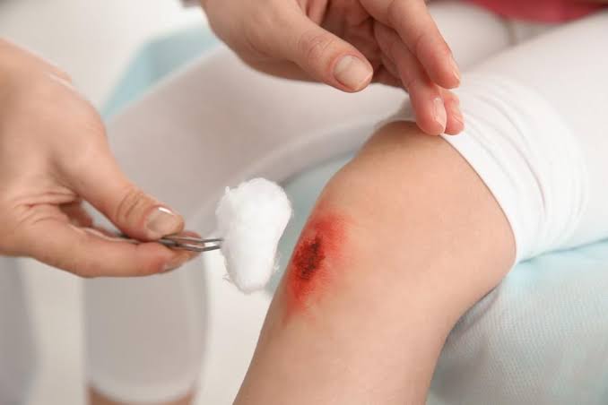 LOCAL AND SYSTEMIC FACTORS AFFECTING TISSUE RENEWAL