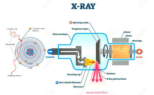 X-RAY TUBE RATINGS AND COMMON FAULTS EXPLAINED