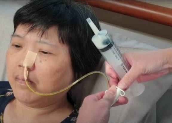 KEY STEPS IN NASOGASTRIC TUBE INSERTION: A PRACTICAL APPROACH FOR NURSES AND DOCTORS