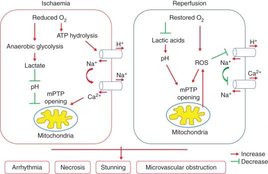 UNDERSTANDING ISCHEMIA AND REPERFUSION INJURY
