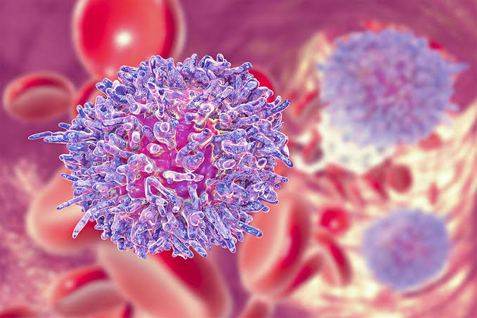CHRONIC LYMPHOPROLIFERATIVE DISORDERS