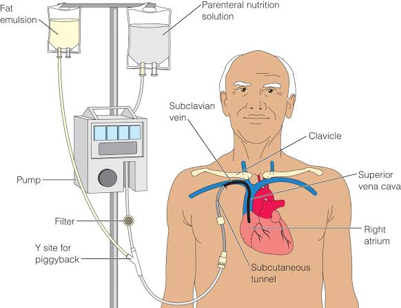 NUTRITIONAL OPTIMISATION