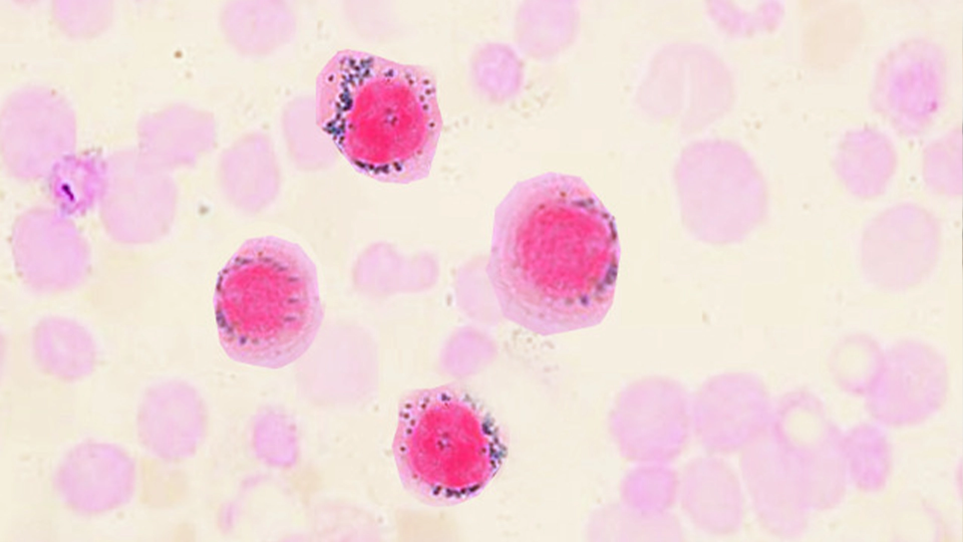 EXPLORING THE PATHOPHYSIOLOGY OF SIDEROBLASTIC ANEMIAS: CAUSES AND MECHANISMS