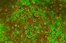 INTRACELLULAR ACCUMULATION