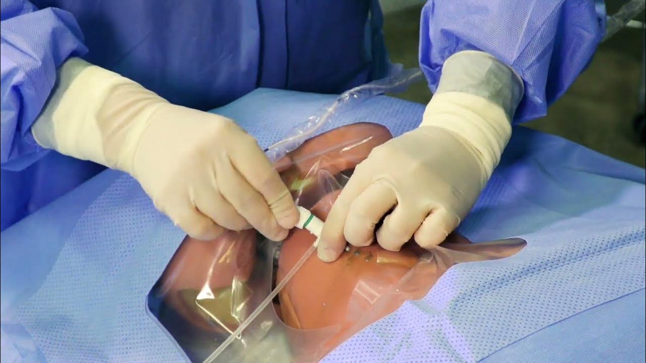 ESSENTIAL TIPS FOR INSERTING A TRANSVENOUS PACEMAKER EFFECTIVELY
