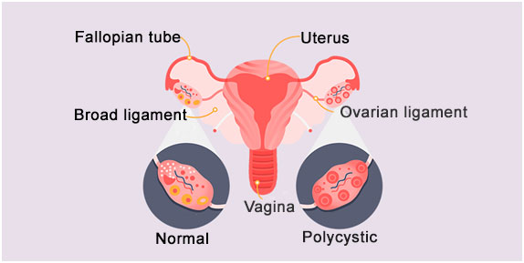 OVULATORY DYSFUNCTION: COMPREHENSIVE INSIGHTS INTO DIAGNOSIS AND CARE