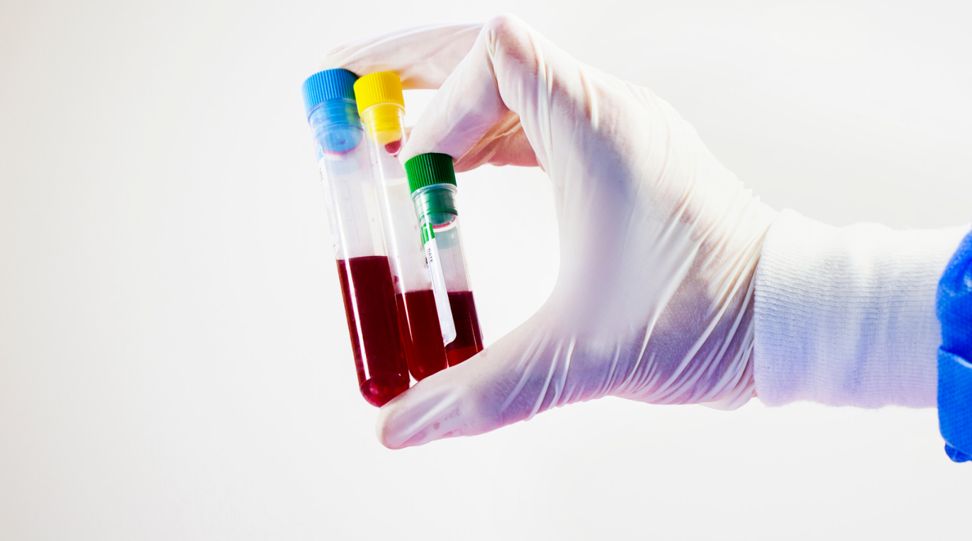 EXPLORING PLASMA PROTEIN ESTIMATION: TECHNIQUES AND CLINICAL IMPORTANCE