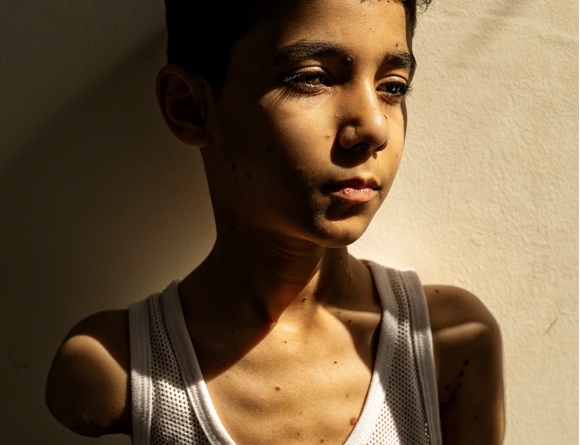 World-Press-Photo-to-portreto