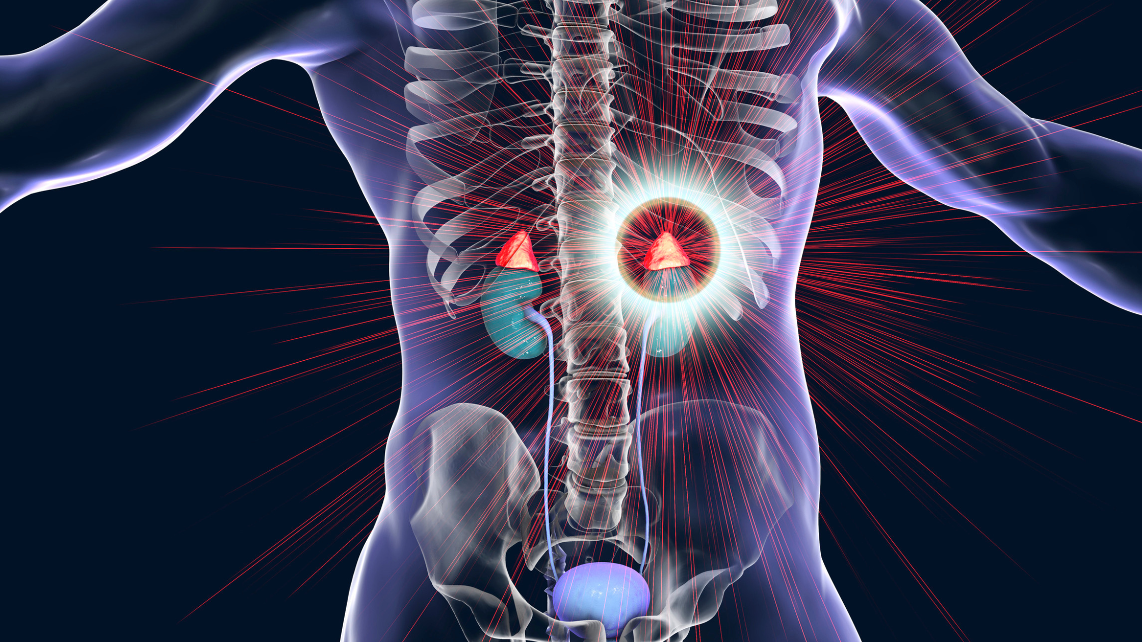 COMPREHENSIVE GUIDE TO SYNDROME OF INAPPROPRIATE ANTIDIURETIC HORMONE SECRETION