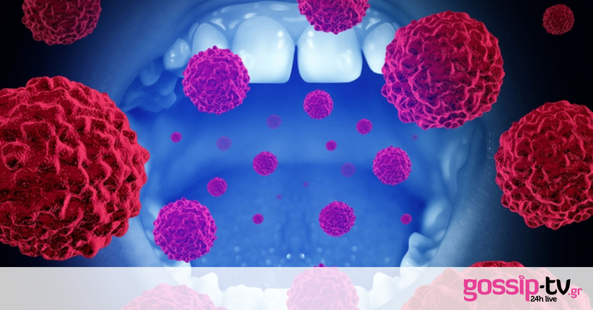 Καρκίνος στόματος: Τα σημάδια που δεν πρέπει να αμελείτε