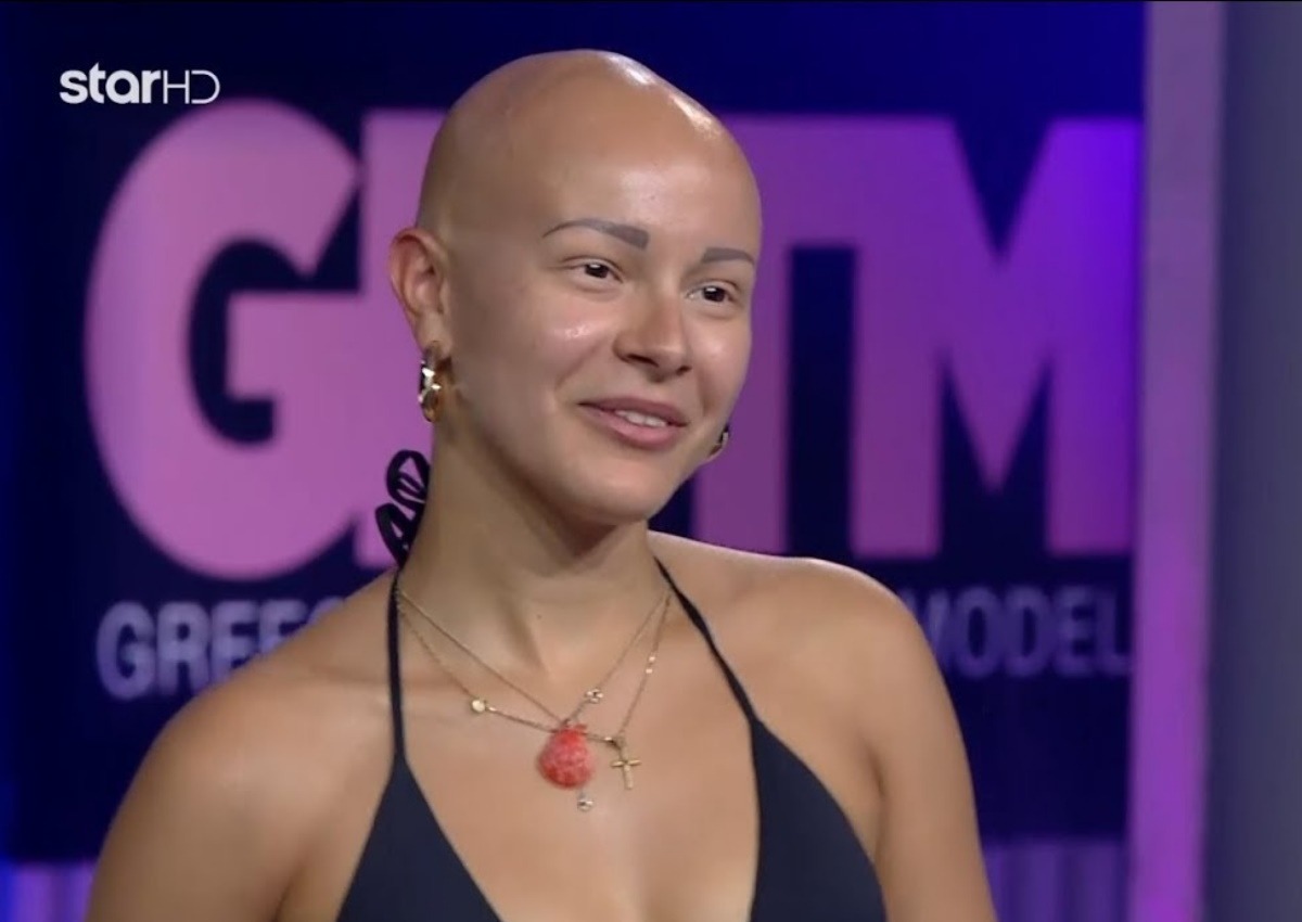 GNTM 2: Η παίκτρια με την αλωπεκία συγκίνησε τους κριτές [video] – TLIFE