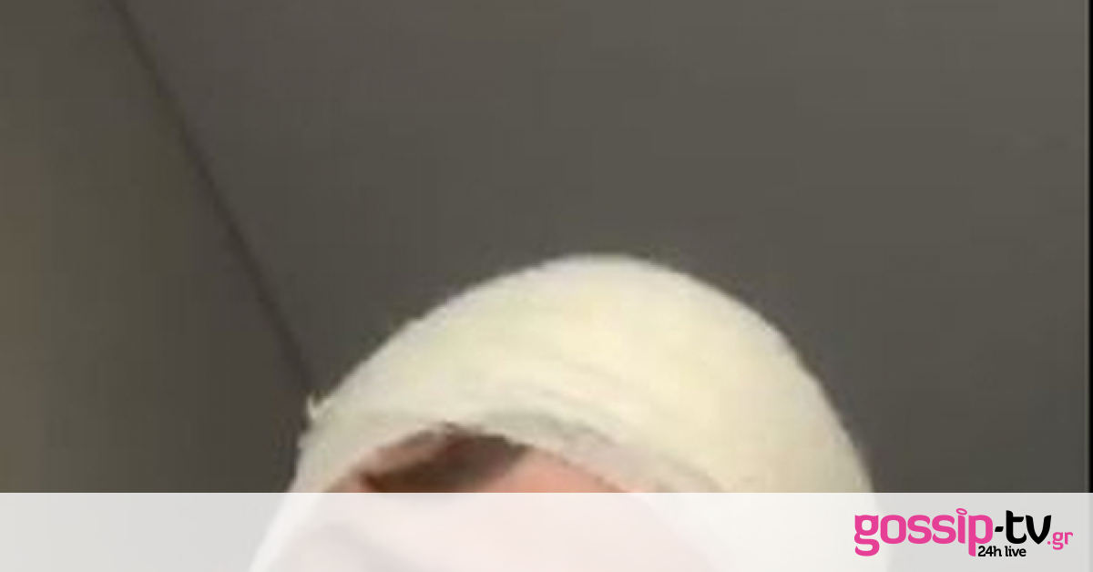 Γνωστός ηθοποιός τραυματίστηκε στο κεφάλι – Εικόνες μέσα από το νοσοκομείο