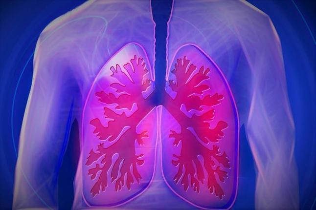 Καρκίνος του πνεύμονα: Κι όμως δεν παρουσιάζει συμπτώματα, πώς και πότε τον καταλαβαίνετε