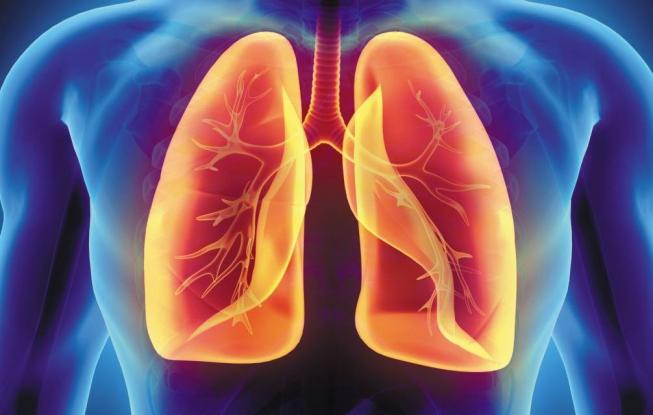 Πνευμονικό οίδημα: Ποια τα επικίνδυνα σημάδια και συμπτώματα