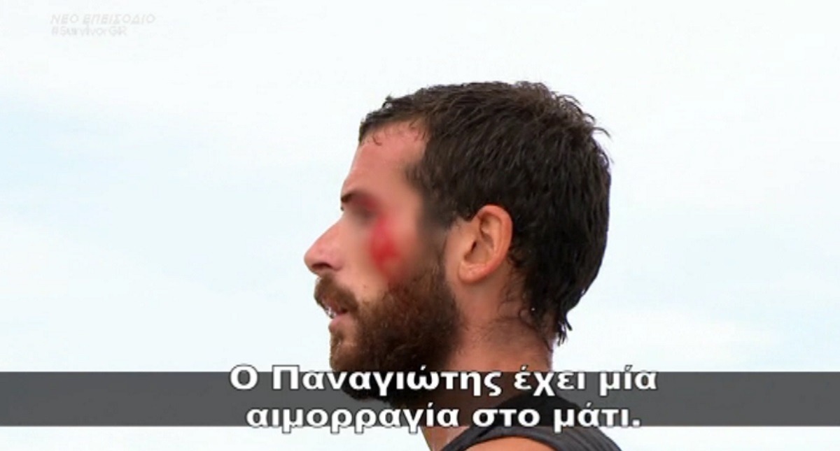 Survivor: Σοβαρός τραυματισμός Έλληνα παίκτη!