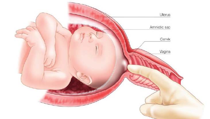 A COMPLETE OVERVIEW OF LABOR INDUCTION: KEY INDICATIONS AND TECHNIQUES