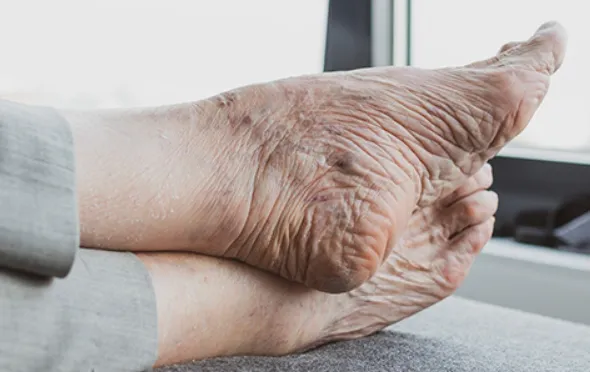 Normal aging changes versus pathological foot problems comparison