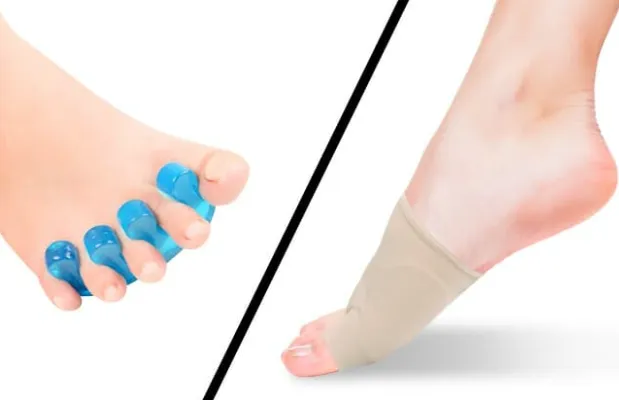 Comprehensive bunion treatment options comparison chart