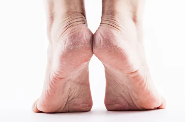 Normal aging foot changes that occur naturally over time