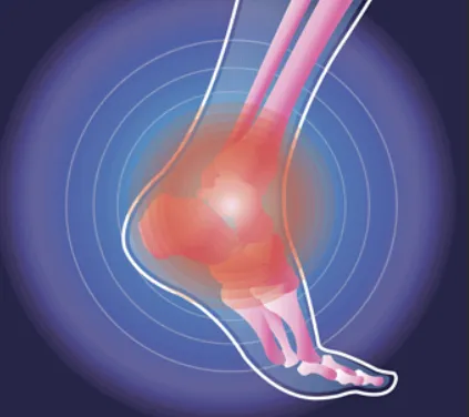 Three pillars of foot health success framework