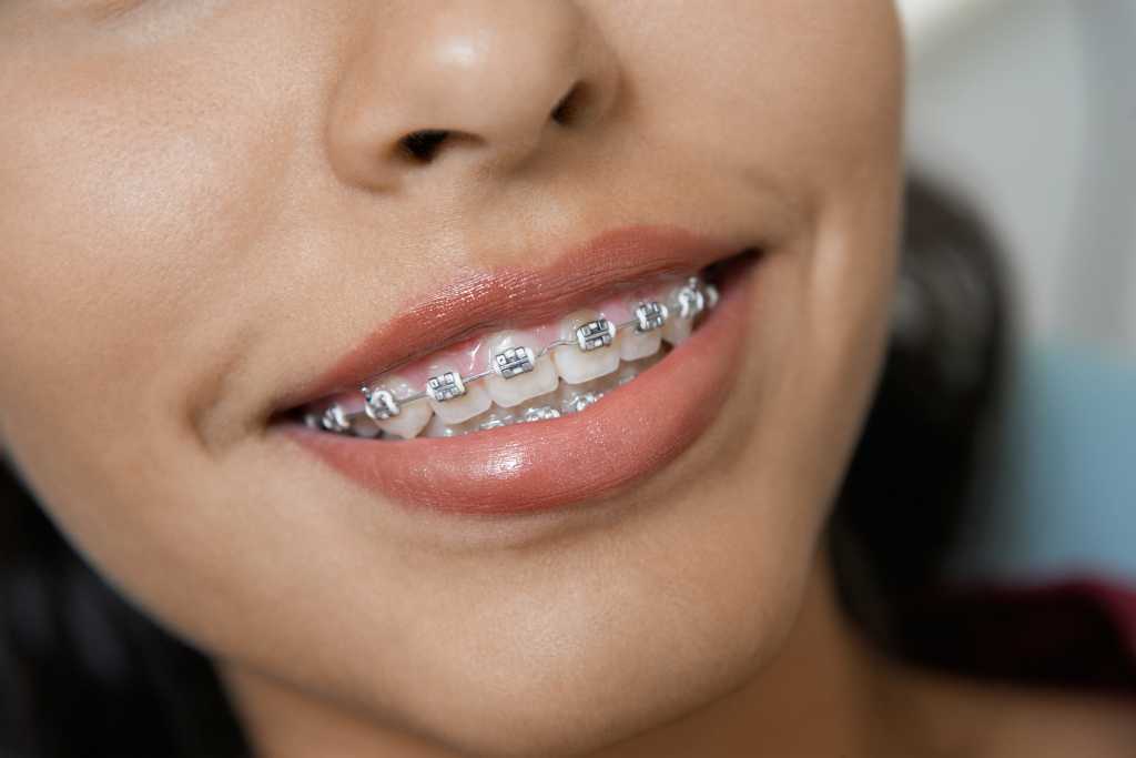 El mejor irrigador dental - Comparativa 2020 49