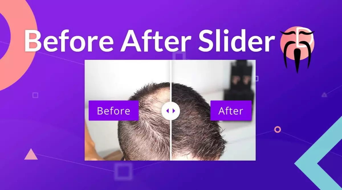 Divi Sensei Before After Slider