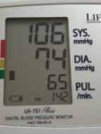 Blood pressure and Heart Rate monitoring by Calgary Nurse Deb Sterling-bauer
