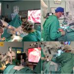 OVERCOMING CHALLENGES IN ANESTHESIA FOR POSTERIOR CRANIAL FOSSA OPERATIONS