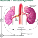 COMPREHENSIVE INSIGHTS INTO RENOVASCULAR HYPERTENSION: DIAGNOSIS AND MANAGEMENT STRATEGIES