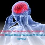 IDIOPATHIC INTRACRANIAL HYPERTENSION OVERVIEW