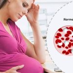 UNDERSTANDING ANEMIA DURING PREGNANCY: KEY FACTS