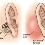 EFFECTIVE CLINICAL APPROACHES FOR MASTOIDITIS DIAGNOSIS AND MANAGEMENT