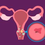 UNDERSTANDING ABNORMAL CERVICAL MUCUS: DIAGNOSIS AND EVIDENCE-BASED TREATMENTS