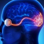 THE ESSENTIAL GUIDE TO NEUROMYELITIS OPTICA SPECTRUM DISORDER: UNLOCKING THE PATH TO EFFECTIVE TREATMENT