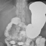 MASTERING THE BASICS: HOW TO UNDERSTAND NORMAL UPPER GASTROINTESTINAL X-RAYS