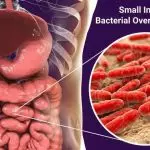 NAVIGATING SMALL INTESTINAL BACTERIAL OVERGROWTH: A COMPREHENSIVE GUIDE TO BETTER GUT HEALTH