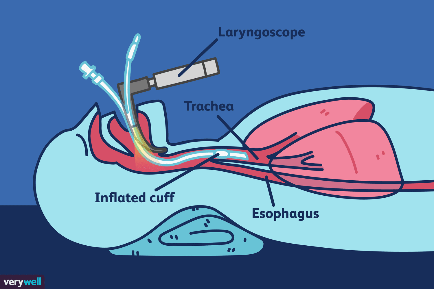 INTUBATION, ANATOMY OF THE AIRWAY AND ANESTHESIA APPARATUS