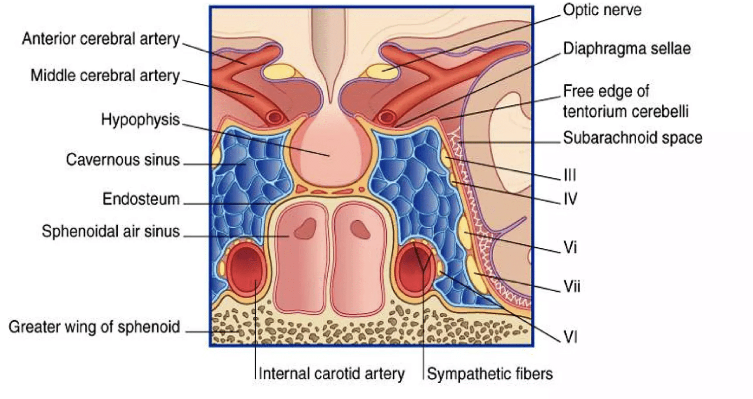 A COMPLETE OVERVIEW OF CAVERNOUS SINUS THROMBOSIS: RECOGNIZING