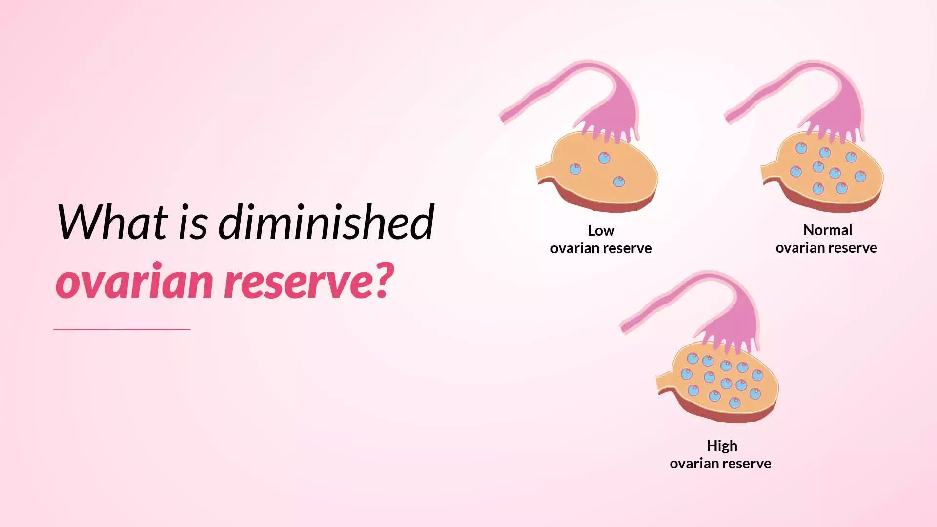 DIMINISHED OVARIAN RESERVE: EXPERT TIPS FOR IMPROVED FERTILITY